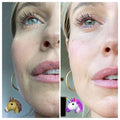PearlPro - Dermaplaning Kit