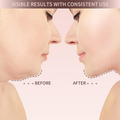 POP Pro - V Line Chin Lifting Mask